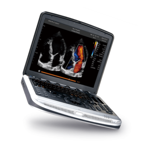 Ultrasonido CHISON Sonobook 8