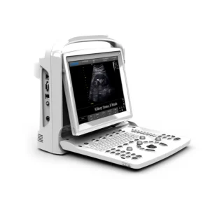 Ultrasonido CHISON ECO 3 EXPERT