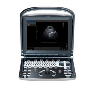 CHISON Ultrasonido ECO 3 PRO EX VET