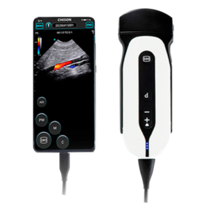 Ultrasonido Portátil CHISON SONOEYE